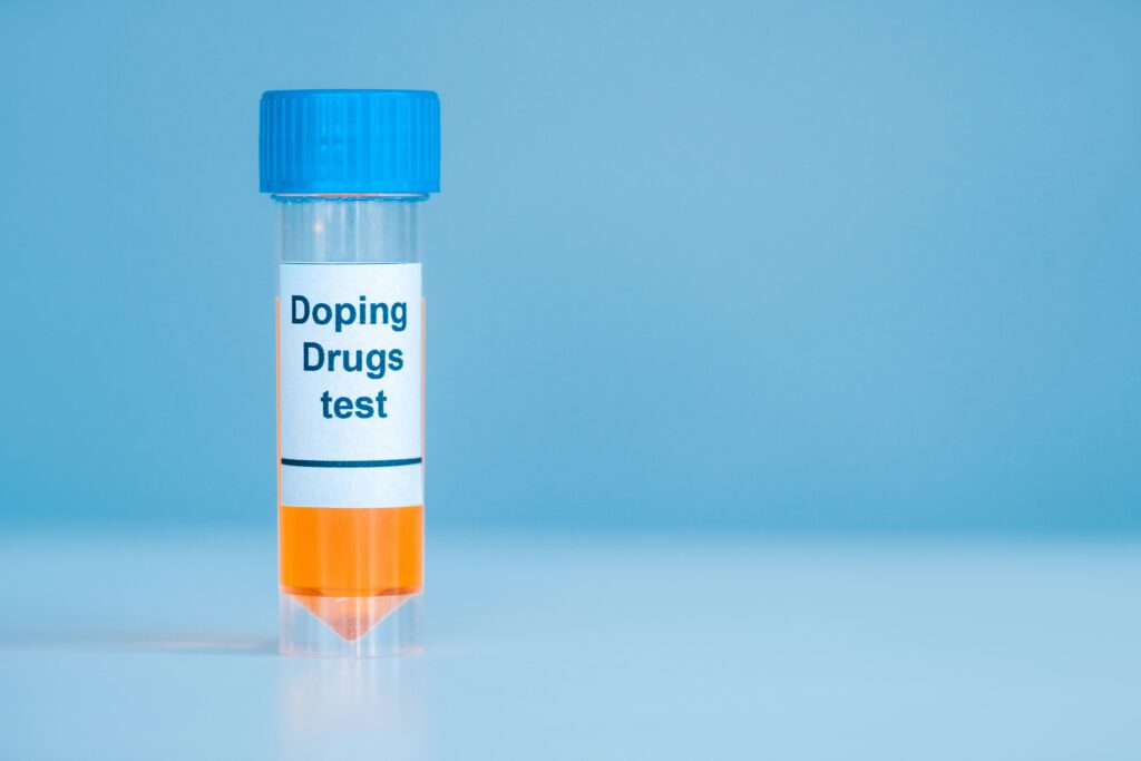 container with urine sample and doping drugs test lettering on blue